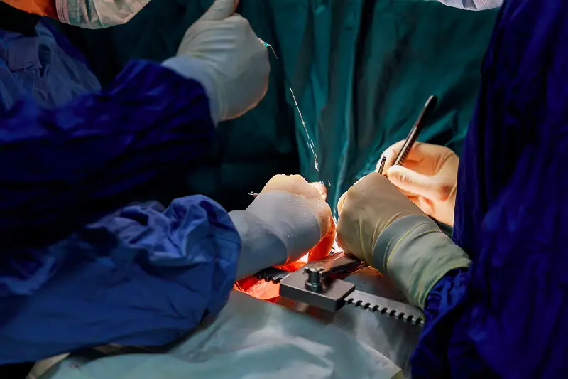 Surgeon hands are tying knot during the open heart procedure chest during heart surgery
